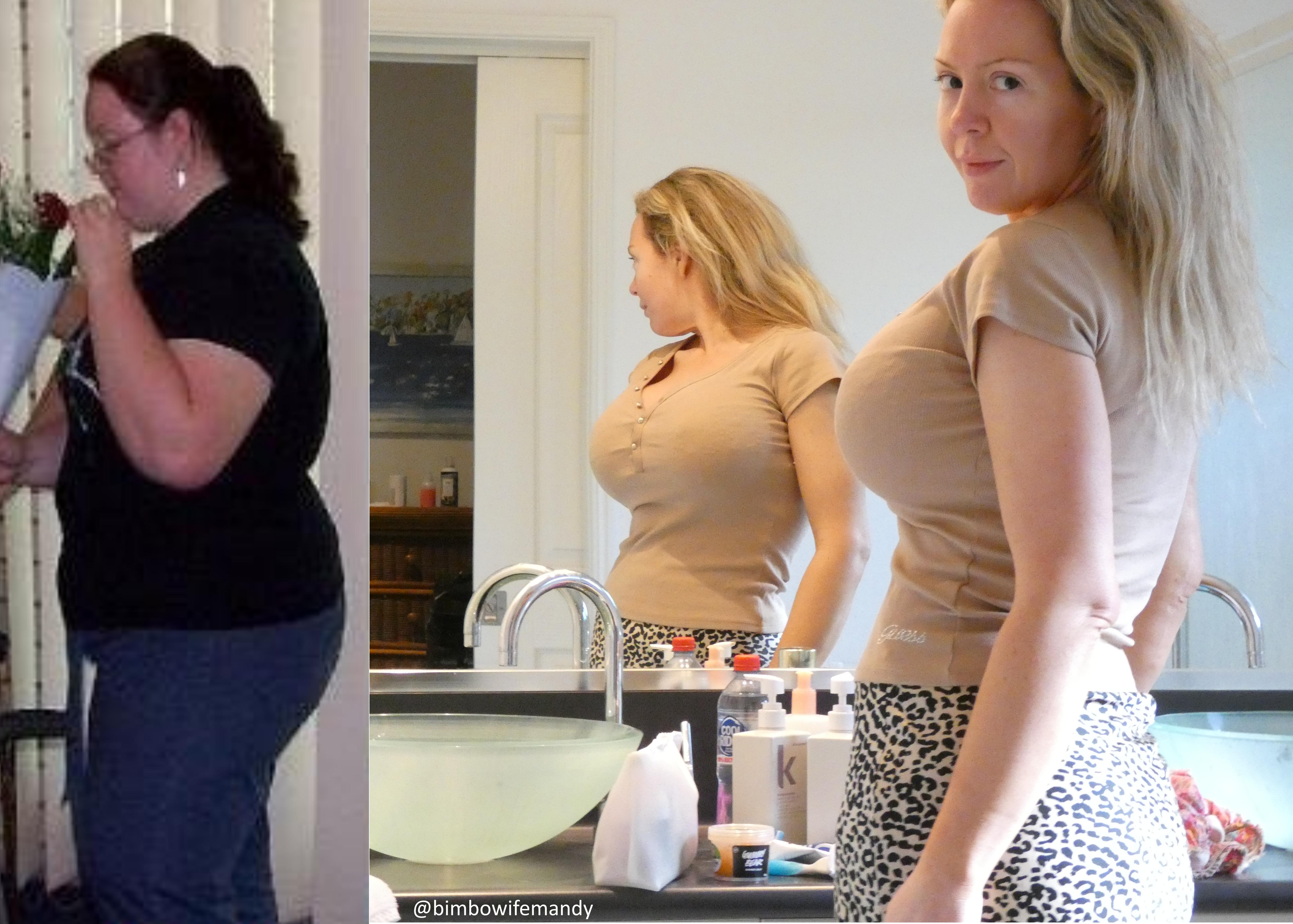 My 37F Bimbofication Journey Weight Loss 1650Cc Breast Implants My 37F Bimbofication Journey Weight Loss 1650Cc Breast Implants