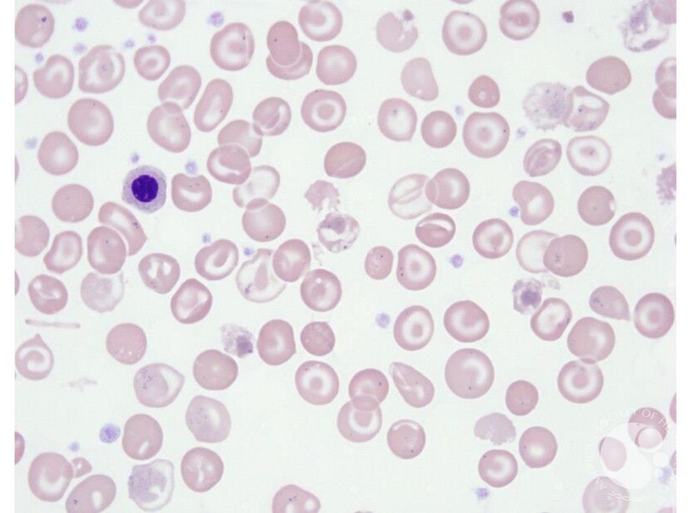Target Cells